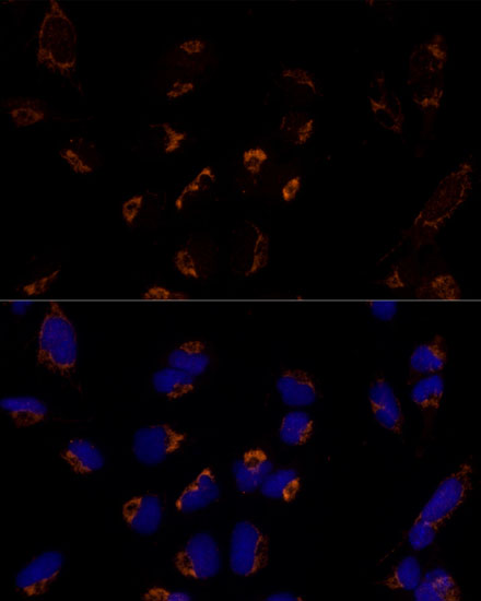 Immunofluorescence analysis of U-2 OS cells using MTCH2 Polyclonal Antibody at dilution of  1:100 (40x lens). Blue: DAPI for nuclear staining.