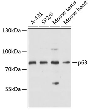 Western blot analysis of extracts of various cell lines using p63 Polyclonal Antibody at dilution of 1:3000.