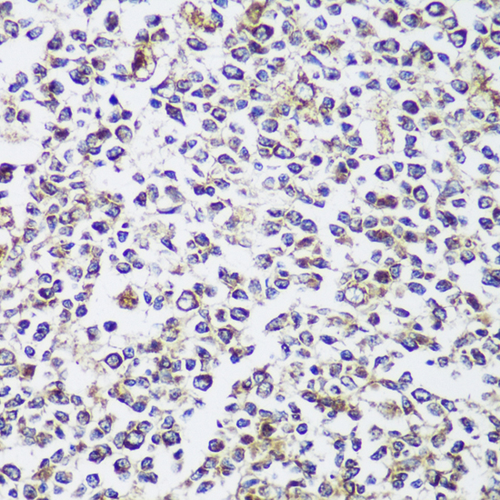 Immunohistochemistry of paraffin-embedded Human tonsil using ECH1 Polyclonal Antibody at dilution of  1:150 (40x lens).