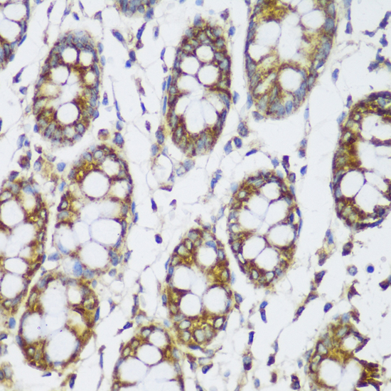 Immunohistochemistry of paraffin-embedded Human colon using ECH1 Polyclonal Antibody at dilution of  1:150 (40x lens).