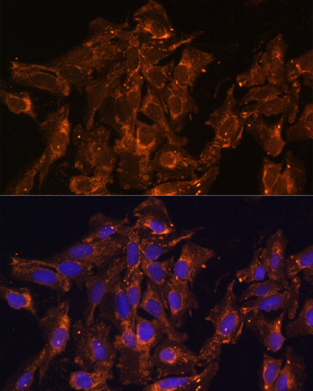 Immunofluorescence analysis of U-2 OS cells using HSD17B8 Polyclonal Antibody at dilution of  1:100 (40x lens). Blue: DAPI for nuclear staining.