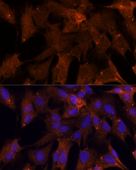 Immunofluorescence analysis of C6 cells using PGK2 Polyclonal Antibody at dilution of  1:100 (40x lens). Blue: DAPI for nuclear staining.