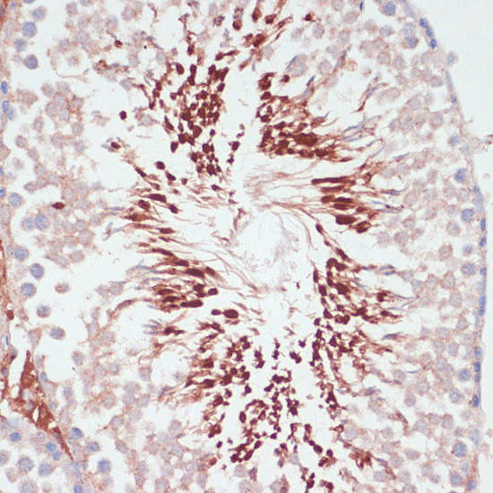 Immunohistochemistry of paraffin-embedded Rat testis using PGK2 Polyclonal Antibody at dilution of  1:100 (40x lens).