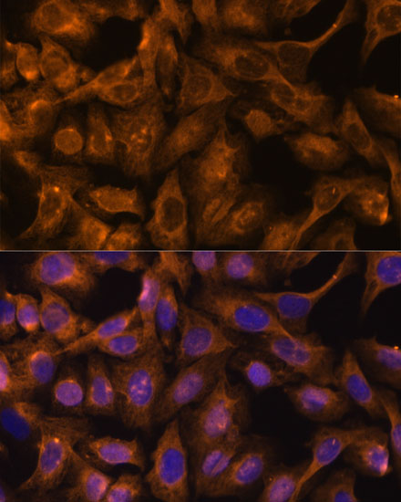 Immunofluorescence analysis of U-2 OS cells using SEPT5 Polyclonal Antibody at dilution of  1:100. Blue: DAPI for nuclear staining.