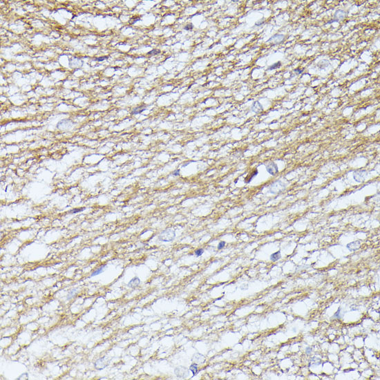 Immunohistochemistry of paraffin-embedded Rat brain using SEPT5 Polyclonal Antibody at dilution of  1:100 (40x lens).