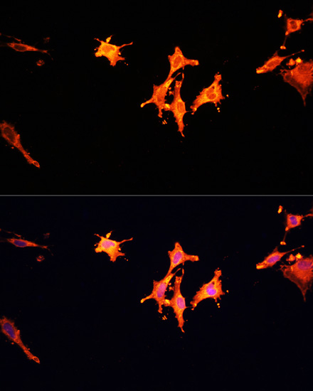 Immunofluorescence analysis of C6 cells using MST1 Polyclonal Antibody at dilution of  1:100. Blue: DAPI for nuclear staining.