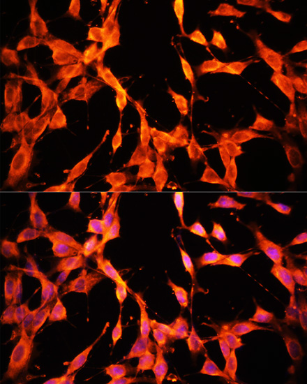 Immunofluorescence analysis of NIH/3T3 cells using MST1 Polyclonal Antibody at dilution of  1:100. Blue: DAPI for nuclear staining.