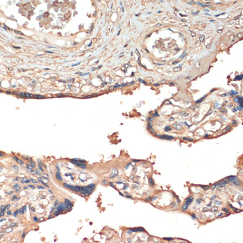 Immunohistochemistry of paraffin-embedded Human placenta using MST1 Polyclonal Antibody at dilution of  1:200 (40x lens).