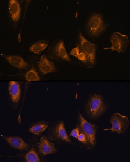 Immunofluorescence analysis of U-2 OS cells using RPL32 Polyclonal Antibody at dilution of  1:100 (40x lens). Blue: DAPI for nuclear staining.