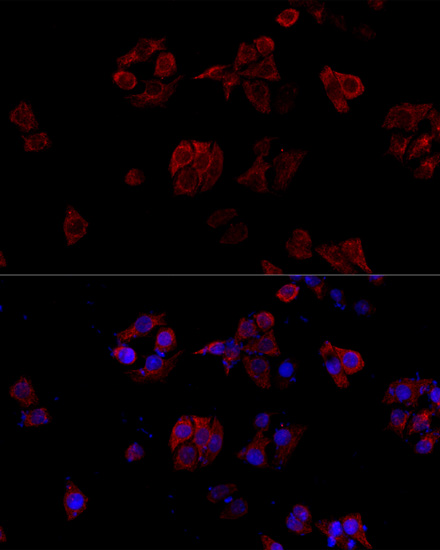 Immunofluorescence analysis of HeLa cells using CD40L Polyclonal Antibody at dilution of  1:100. Blue: DAPI for nuclear staining.