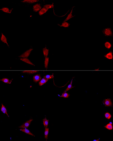 Immunofluorescence analysis of NIH/3T3 cells using CD40L Polyclonal Antibody at dilution of  1:100. Blue: DAPI for nuclear staining.