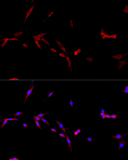 Immunofluorescence analysis of PC-12 cells using CD40L Polyclonal Antibody at dilution of  1:100. Blue: DAPI for nuclear staining.