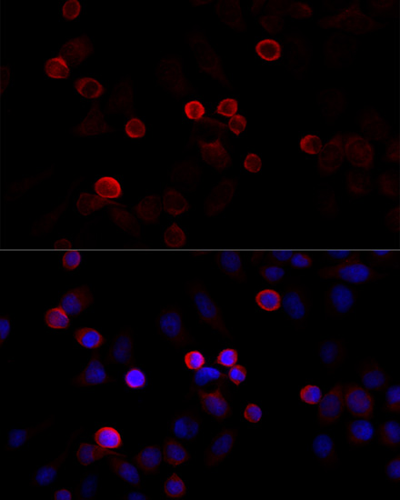 Immunofluorescence analysis of HeLa cells using FLNC Polyclonal Antibody at dilution of  1:100 (40x lens). Blue: DAPI for nuclear staining.