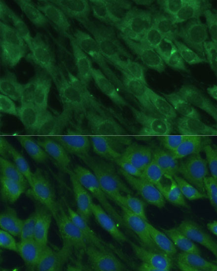 Immunofluorescence analysis of C6 cells using HAL Polyclonal Antibody at dilution of  1:100 (40x lens). Blue: DAPI for nuclear staining.