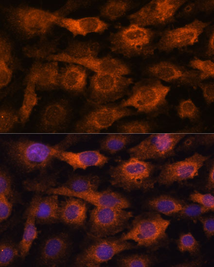 Immunofluorescence analysis of C6 cells using IFITM3 Polyclonal Antibody at dilution of  1:100. Blue: DAPI for nuclear staining.