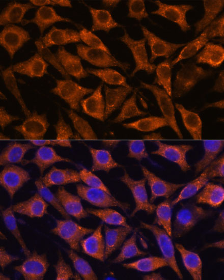 Immunofluorescence analysis of L929 cells using IFITM3 Polyclonal Antibody at dilution of  1:100. Blue: DAPI for nuclear staining.