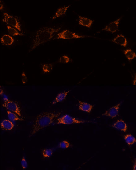 Immunofluorescence analysis of NIH-3T3 cells using PRDX3 Polyclonal Antibody at dilution of  1:100 (40x lens). Blue: DAPI for nuclear staining.