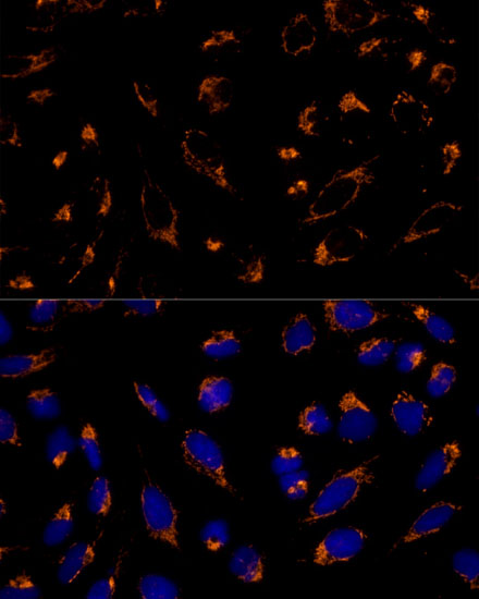 Immunofluorescence analysis of U-2 OS cells using PRDX3 Polyclonal Antibody at dilution of  1:100 (40x lens). Blue: DAPI for nuclear staining.