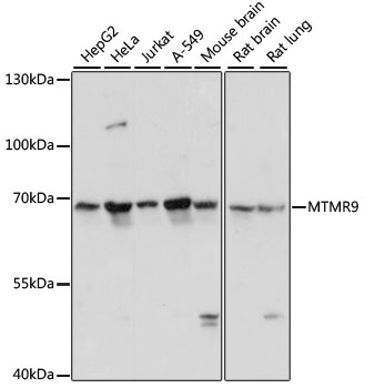 Western blot analysis of extracts of various cell lines using MTMR9 Polyclonal Antibody at dilution of 1:3000.