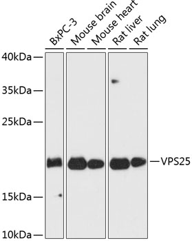 Western blot analysis of extracts of various cell lines using VPS25 Polyclonal Antibody at dilution of 1:3000.