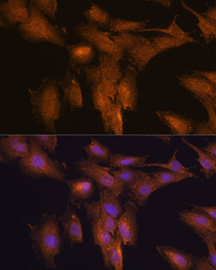 Immunofluorescence analysis of C6 cells using TSLP Polyclonal Antibody at dilution of  1:100. Blue: DAPI for nuclear staining.