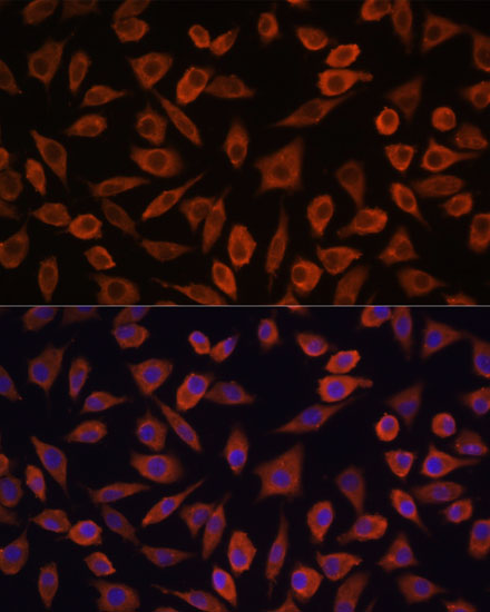 Immunofluorescence analysis of L929 cells using TSLP Polyclonal Antibody at dilution of  1:100. Blue: DAPI for nuclear staining.