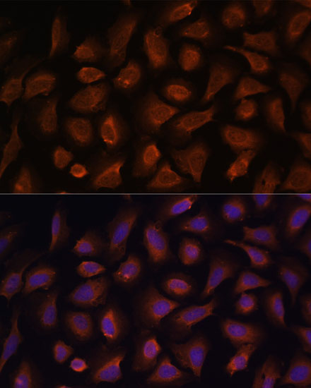 Immunofluorescence analysis of U-2 OS cells using TSLP Polyclonal Antibody at dilution of  1:100. Blue: DAPI for nuclear staining.