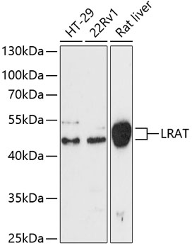 Western blot analysis of extracts of various cell lines using LRat Polyclonal Antibody at dilution of 1:3000.