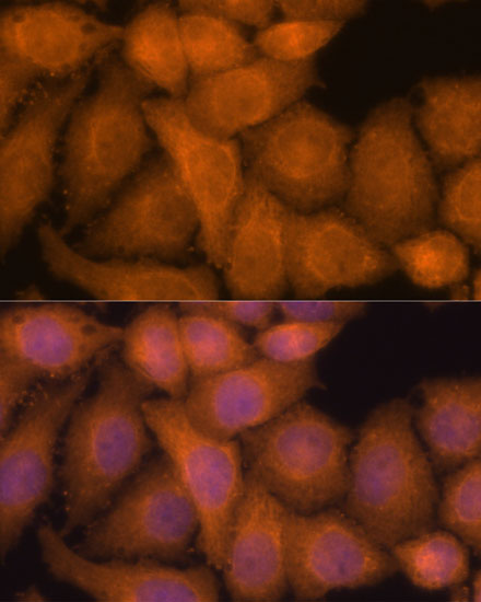 Immunofluorescence analysis of HeLa cells using ZC3H7A Polyclonal Antibody at dilution of  1:100. Blue: DAPI for nuclear staining.