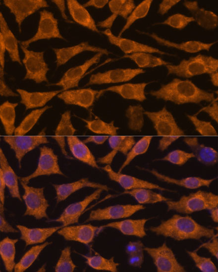 Immunofluorescence analysis of L929 cells using ZC3H7A Polyclonal Antibody at dilution of  1:100. Blue: DAPI for nuclear staining.