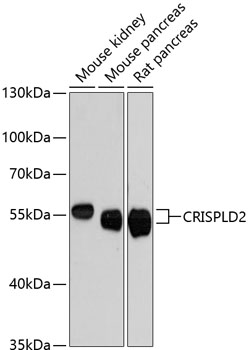 Western blot analysis of extracts of various cell lines using CRISPLD2 Polyclonal Antibody at dilution of 1:3000.