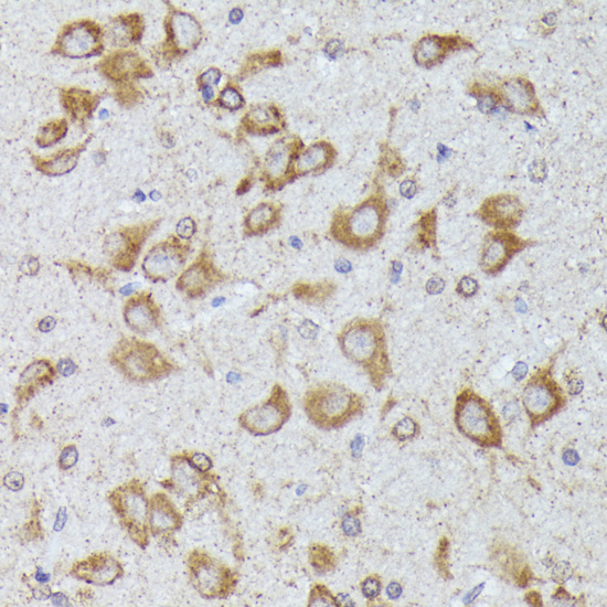 Immunohistochemistry of paraffin-embedded Rat brain using TBCB Polyclonal Antibody at dilution of  1:100 (40x lens).