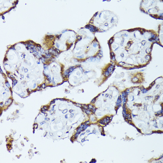 Immunohistochemistry of paraffin-embedded Human placenta using TBCB Polyclonal Antibody at dilution of  1:100 (40x lens).