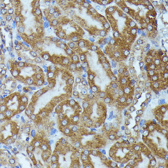 Immunohistochemistry of paraffin-embedded Mouse kidney using TBCB Polyclonal Antibody at dilution of  1:100 (40x lens).