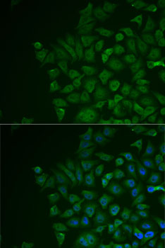Immunofluorescence analysis of MCF7 cells using LRat Polyclonal Antibody