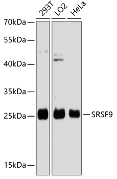 Western blot analysis of extracts of various cell lines using SFRS9 Polyclonal Antibody at dilution of 1:3000.