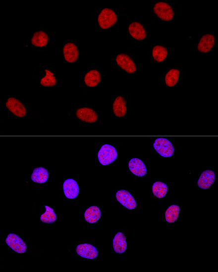 Confocal immunofluorescence analysis of U-2 OS cells using CTCF Polyclonal Antibody at dilution of  1:100. Blue: DAPI for nuclear staining.