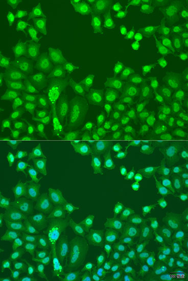 Immunofluorescence analysis of U2OS cells using CTCF Polyclonal Antibody at dilution of  1:100. Blue: DAPI for nuclear staining.