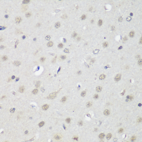 Immunohistochemistry of paraffin-embedded Rat brain using CTCF Polyclonal Antibody at dilution of  1:200 (40x lens).