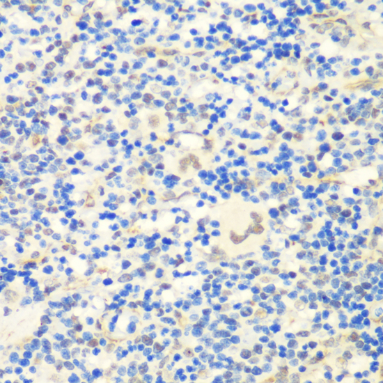 Immunohistochemistry of paraffin-embedded Rat spleen using CTCF Polyclonal Antibody at dilution of  1:200 (40x lens).