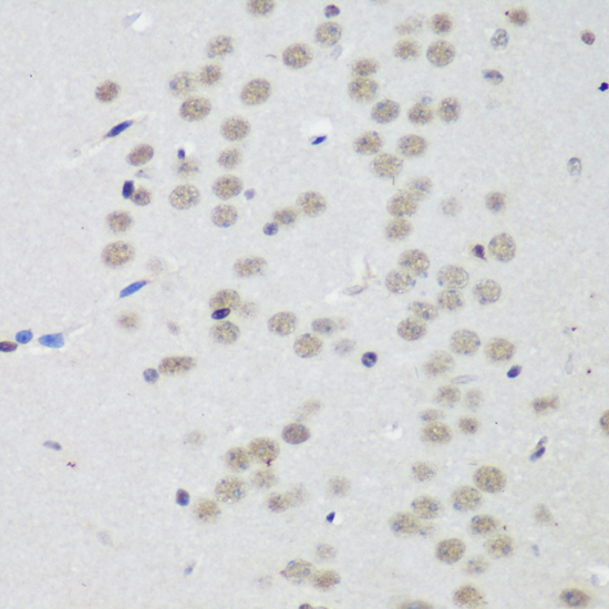 Immunohistochemistry of paraffin-embedded Mouse brain using CTCF Polyclonal Antibody at dilution of  1:200 (40x lens).