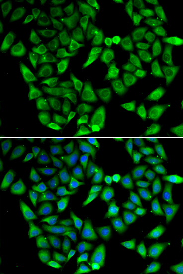 Immunofluorescence analysis of HeLa cells using ASIP Polyclonal Antibody