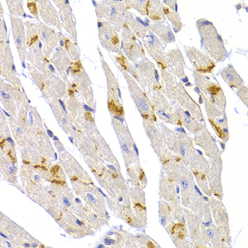 Immunohistochemistry of paraffin-embedded Mouse heart using Desmoplakin Polyclonal Antibody at dilution of  1:100 (40x lens).