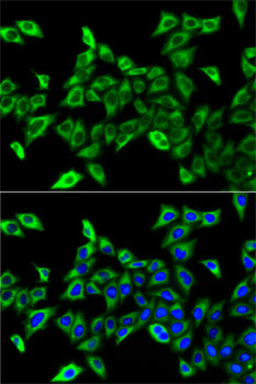 Immunofluorescence analysis of A-549 cells using HADHA Polyclonal Antibody