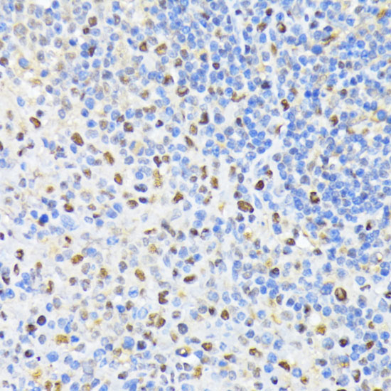 Immunohistochemistry of paraffin-embedded Rat spleen using PCNA Polyclonal Antibody at dilution of  1:100 (40x lens).