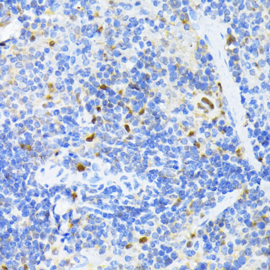 Immunohistochemistry of paraffin-embedded Mouse spleen using PCNA Polyclonal Antibody at dilution of  1:100 (40x lens).