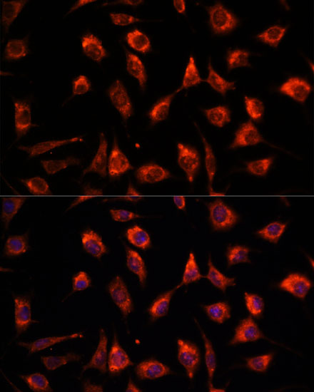 Immunofluorescence analysis of L929 cells using TPT1 Polyclonal Antibody at dilution of  1:100. Blue: DAPI for nuclear staining.