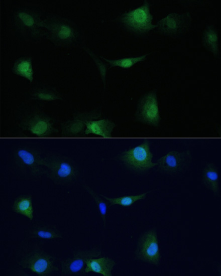 Immunofluorescence analysis of C6 cells using VCP Polyclonal Antibody at dilution of  1:100. Blue: DAPI for nuclear staining.