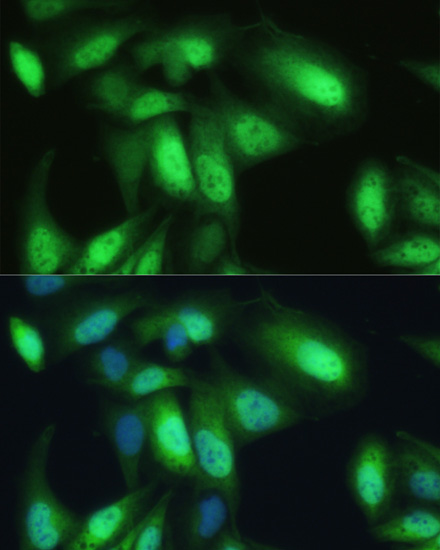Immunofluorescence analysis of U-2 OS cells using VCP Polyclonal Antibody at dilution of  1:100. Blue: DAPI for nuclear staining.