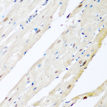 Immunohistochemistry of paraffin-embedded Rat heart using VCP Polyclonal Antibody at dilution of  1:200 (40x lens).